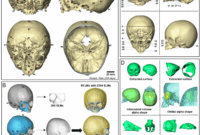 Normal Human Craniofacial Growth And Development From 0 To 4 Years Scientific Reports