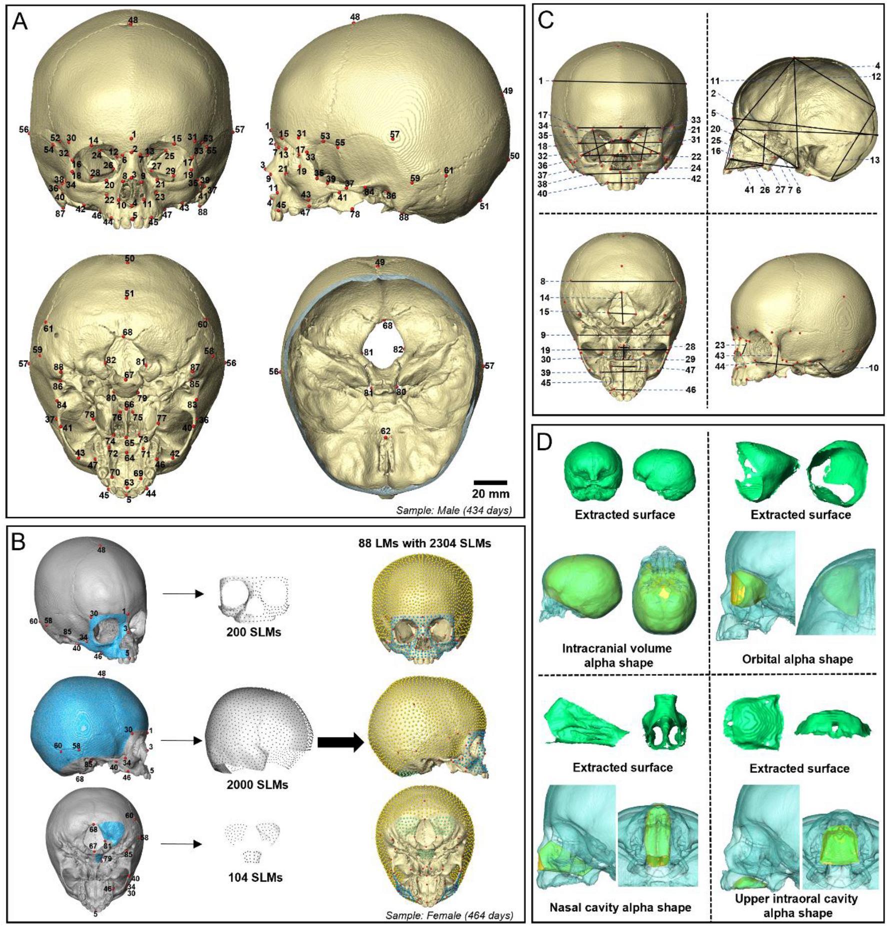 Normal Human Craniofacial Growth And Development From 0 To 4 Years Scientific Reports